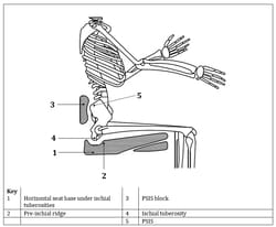 Figura 2. Posicionamiento de soportes posturales primarios para posicionar la pelvis (ISO/TS 16840-15 1)